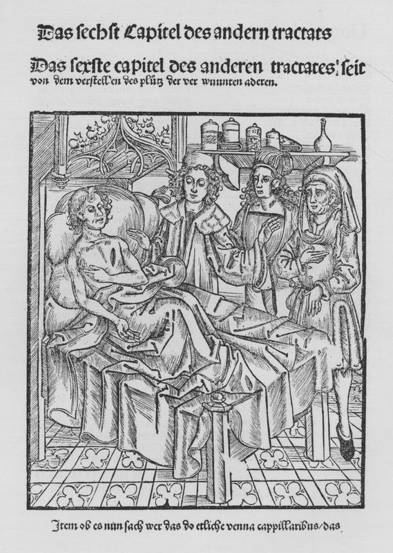 Het Boek van Cirurgia door Hieronymus Brunschwig door (after) German School