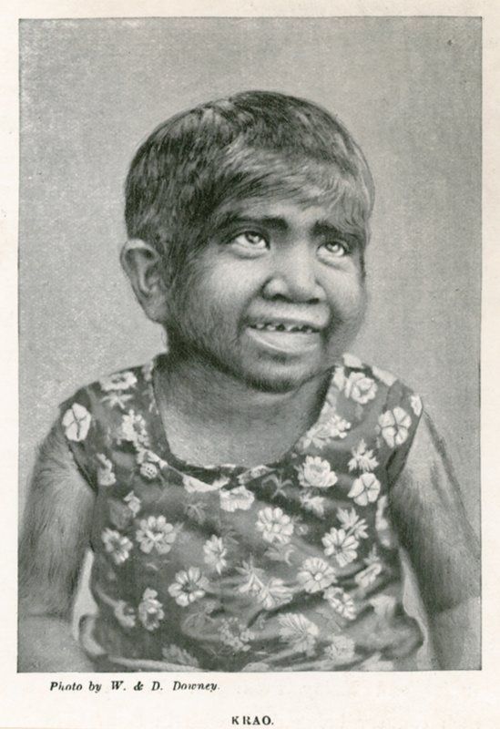 Krao, De Missing Link, tentoongesteld in het Aquarium, Westminster, Londen, in 1887 door English Photographer