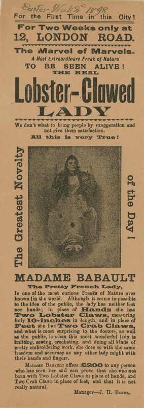 Advertentie voor een optreden van Madame Babault, de kreeftklauw dame door English School