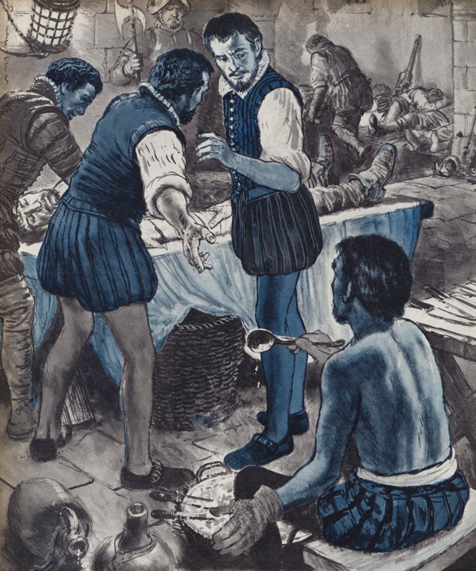 Ambroise Pare, militaire chirurg, toen de olie op was door English School