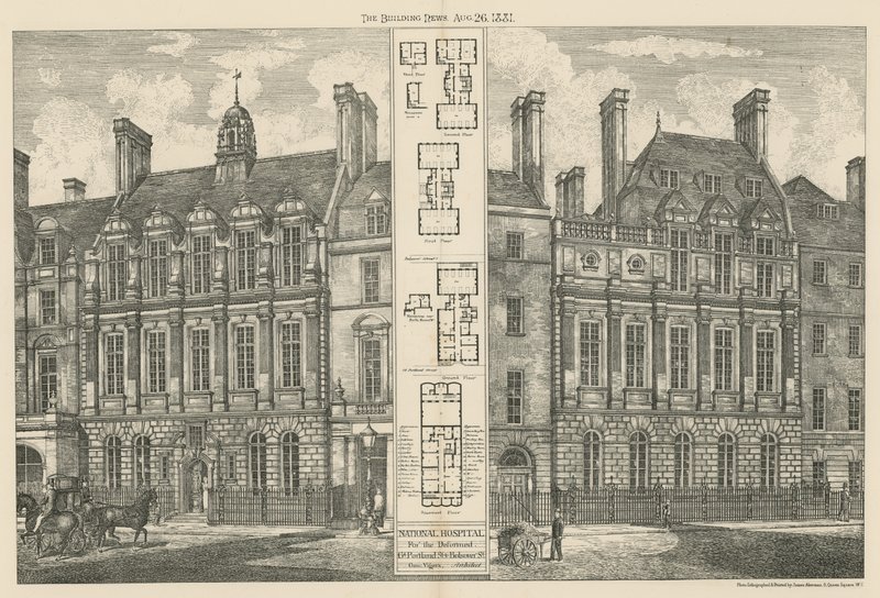 Nationaal Ziekenhuis voor de Misvormden, Great Portland Street, en Bolsover Street door English School