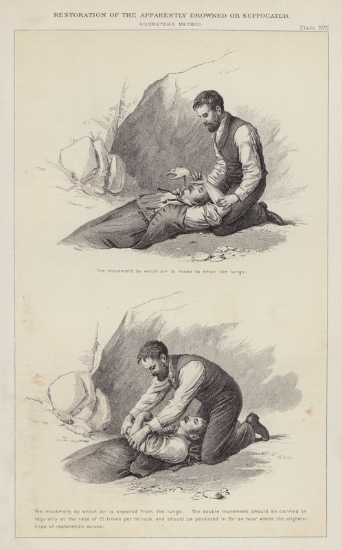 Herstel van de schijnbaar verdronken of verstikte (gravure) door English School