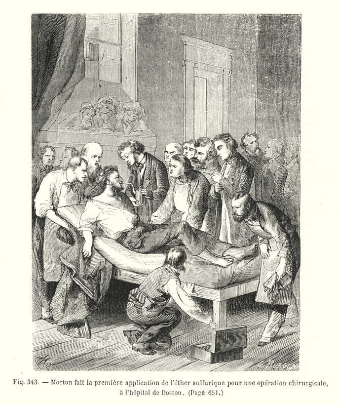 Morton doet de eerste toepassing van zwavelige ether voor een chirurgische operatie, in het ziekenhuis van Boston door European School