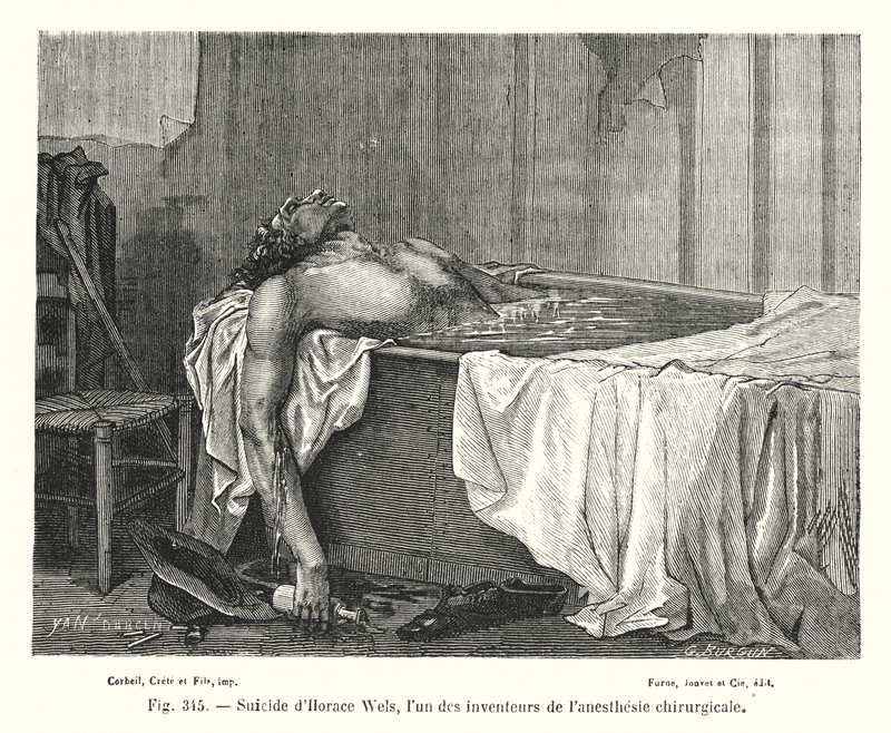 Zelfmoord van Horace Wels, een van de uitvinders van chirurgische anesthesie door European School