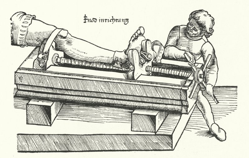 Apparaat voor het rechtzetten van een gewonde been (gravure) door German School