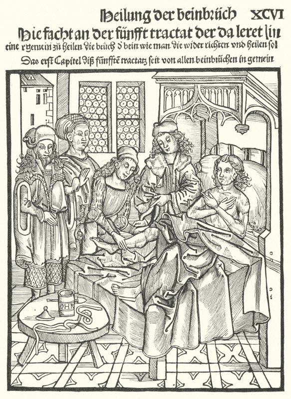 Dokters aan het bed van een man met een gebroken been (gravure) door German School