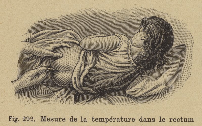 Temperatuur van een kind nemen via het rectum door German School