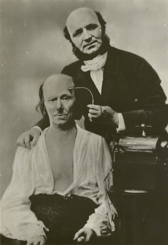 Franse neuroloog Duchenne de Boulogne gebruikt zijn elektrofysiologie-apparaat op een oude man door Guillaume Benjamin Armand Duchenne de Boulogne