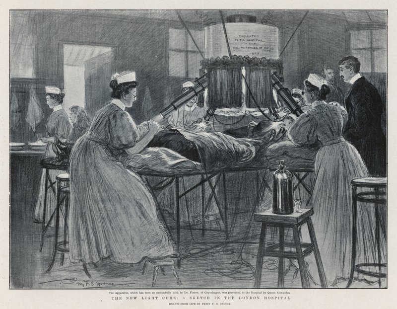De nieuwe lichttherapie: Een schets in het London Hospital door Percy F.S. Spence