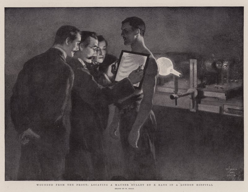 Gewonden van het Front, lokaliseren van een Mauser Kogel met Röntgenstralen in een Londens Ziekenhuis door William Small