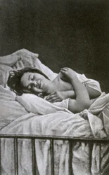 Jonge vrouw met een aanval van hysterie, 1878