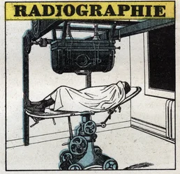 Röntgenstralen: Röntgenapparaat. Anonieme illustratie uit 1925. Privécollectie.