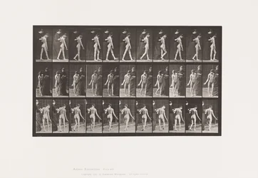 Plaat 541. Meervoudige Cerebro-Spinale Sclerose (Choreic); Wandelen