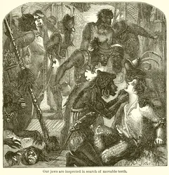 Onze Kaken worden Geïnspecteerd op Losse Tanden