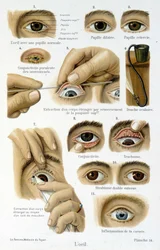Geneeskunde: het oog
