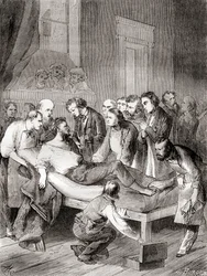 De eerste openbare demonstratie van het gebruik van ingeademde ether als chirurgisch anestheticum in 1846 door een Amerikaanse tandarts, William Thomas Green Morton, uit 