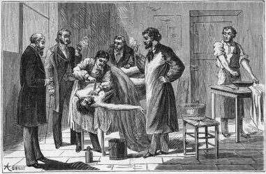 Gebruik van soda sulfiet in dissectie amfitheaters om lijken te bewaren - Gravure in 