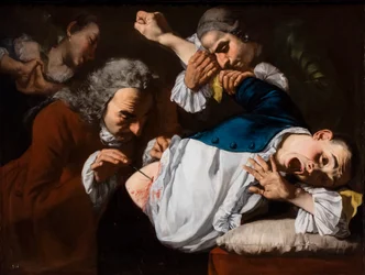 De operatie, circa 1753/54 (Olieverf op doek)