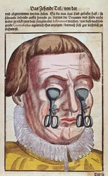 Behandeling van een oogkwaal, uit Ophthalmodouleia door Georg Bartisch, gepubliceerd in Dresden in 1583