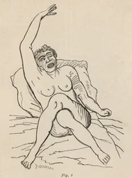 Hysterische epilepsie, aanval, vervormingen, fig. 1 uit 