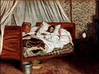 De geïmproviseerde ambulance (Claude Monet gewond). Schilderij door Jean Frederic Bazille (1841-1870)