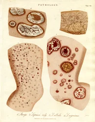 Pathologische huidaandoeningen: Schurigie; Schrale huid; Pallada en Impetigo