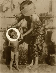 Moedervlek (Salome)