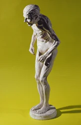 Beeld van een vrouw met de ziekte van Parkinson