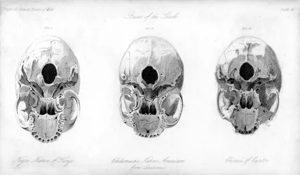 Basis van de schedel, 1848