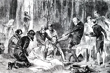 Ambroise Pare verwijdert een lans uit het gezicht van de hertog van Guise