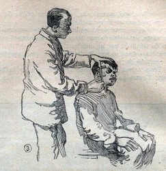 De gerechtelijke antropometrie of bertillonnage, methode van Alphonse Bertillon (1853-1914): meting van het oor - Gravure in 