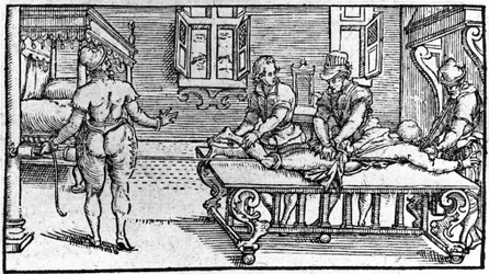 Reductie van een ontwrichting, in "Traité Médical" door Ambroise Paré, circa 1560